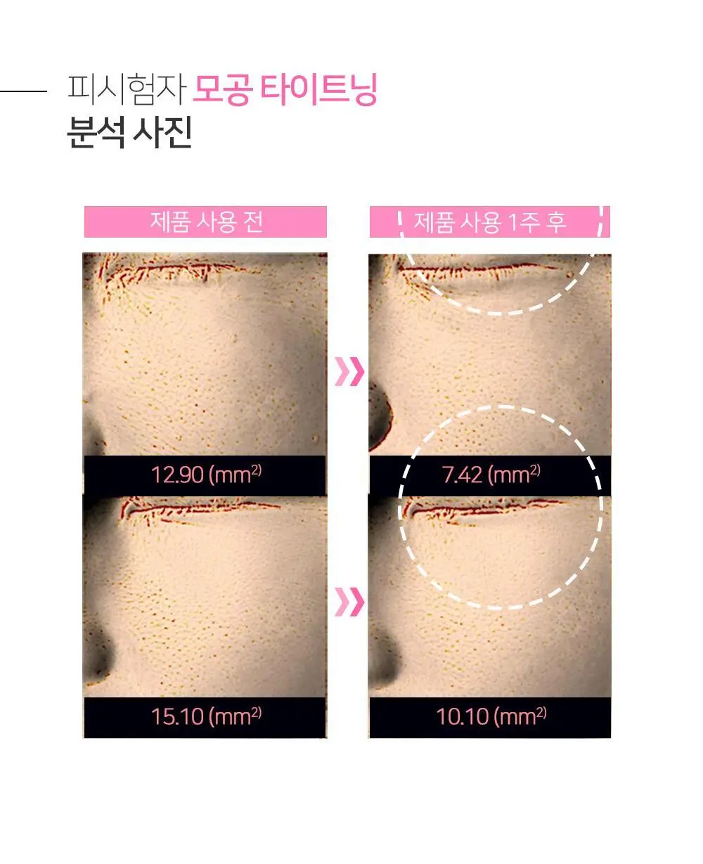 [숌.지복합성피부] 결정리 리페어 클렌징밤 100ml 상세페이지 38
